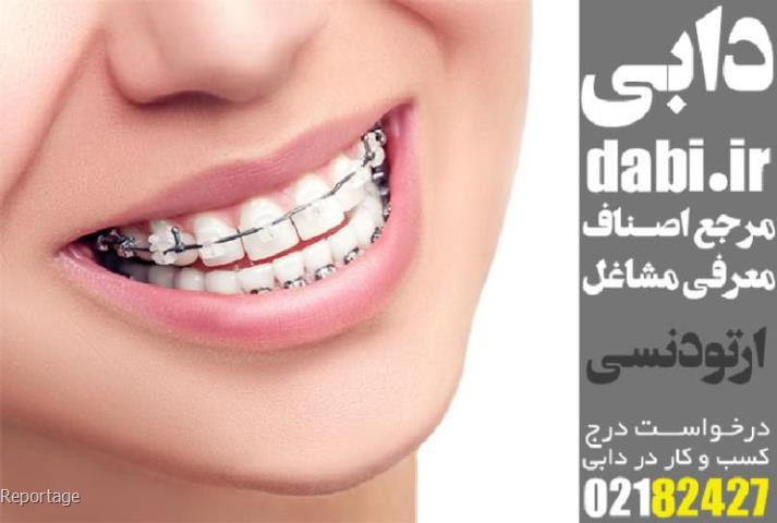 متخصص ایمپلنت در تهران