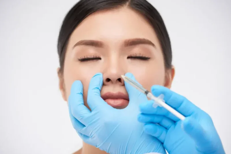 هر آنچه پیش از تزریق فیلر بینی باید بدانید